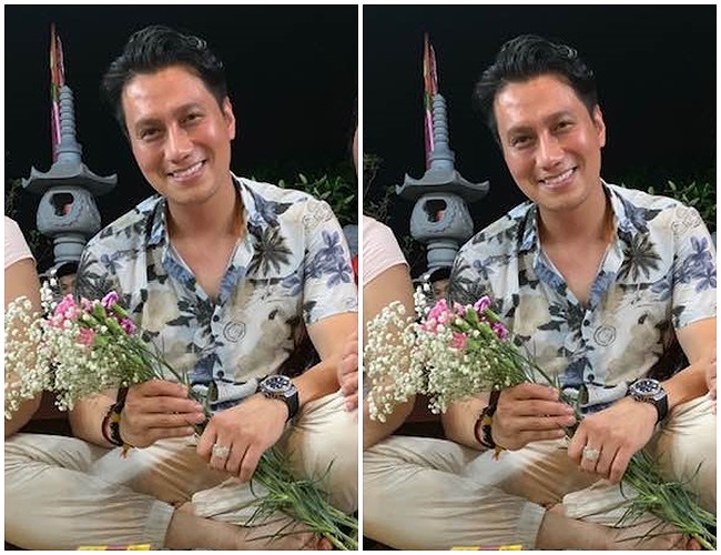 nhan sắc gây tiếc nuối sau khi thẩm mỹ của Việt An